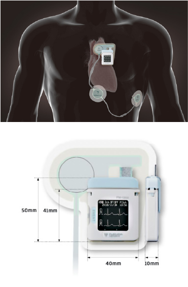 ホルター心電図検査の医療機器写真、装着イメージ